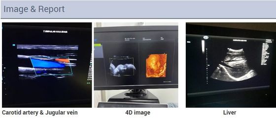 машина ультразвука Doppler цвета отголоска вагонетки 2D эхокардиографии 3D 4D сердечная