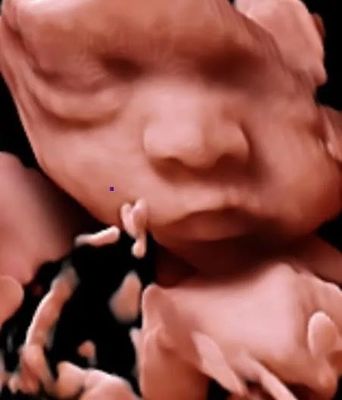 блок развертки ультразвука вагонетки ультразвука Doppler цвета 3D 4D 5D для OB GYN